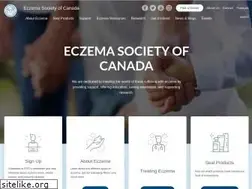 Sites similar to eczemahelp.ca