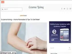 Sites similar to eczemaliving.com