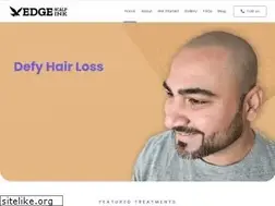 Sites similar to edgescalpink.com