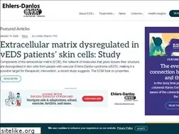 Sites similar to ehlersdanlosnews.com