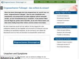 Sites similar to eingewachsener-zehennagel.net