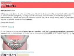 Sites similar to eliminaherpes.com