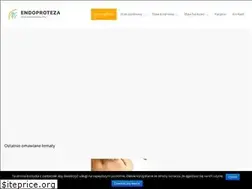 Sites similar to endoproteza.info