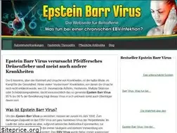 Sites similar to epstein-barr-virus24.de