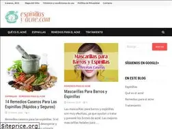 Sites similar to espinillasyacne.com