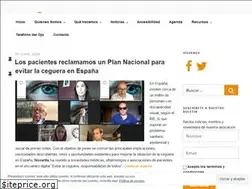 Sites similar to esvision.es
