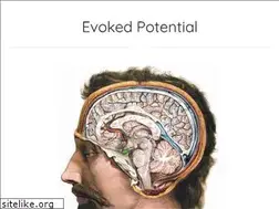 Sites similar to evokedpotential.com