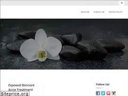Sites similar to facialsteaming.com