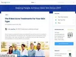 Sites similar to facingacne.com