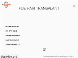 Sites similar to ferhadyildiz.com