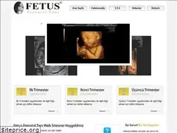 Sites similar to fetus.com.tr