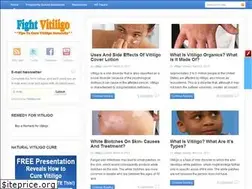 Sites similar to fightvitiligo.com