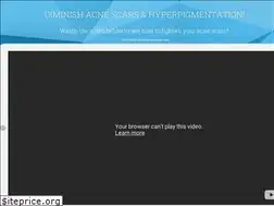 Sites similar to fixmyskinfast.com