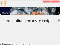 Sites similar to footcallusremover.com