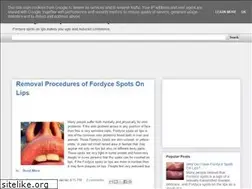 Sites similar to fordycespotsonlips.blogspot.com