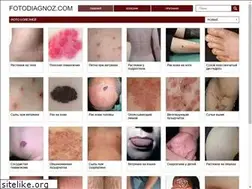 Sites similar to fotodiagnoz.com