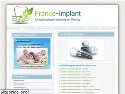 Sites similar to france-implant.fr