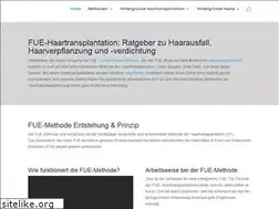 Sites similar to fue-haartransplantation.com