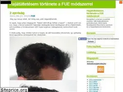 Sites similar to fue-hajbeultetes.blog.hu