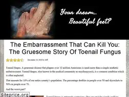 Sites similar to fungalnailcures.com