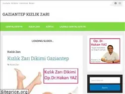 Sites similar to gaziantepkizlikzari.com