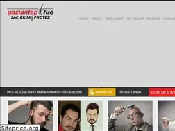 Sites similar to gaziantepprotezsac.com