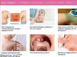 Sites similar to gerpes03.ru