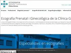 Sites similar to ginecoprenatal.cat