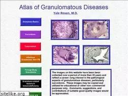 Sites similar to granuloma.homestead.com