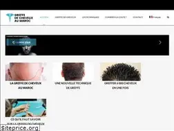 Sites similar to greffe-cheveux-maroc.com