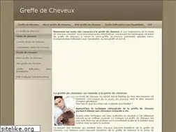 Sites similar to greffedecheveux.fr