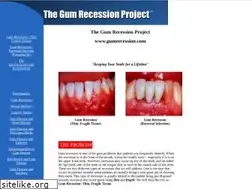 Sites similar to gumrecession.com