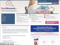 Sites similar to gynultrazvuk.cz