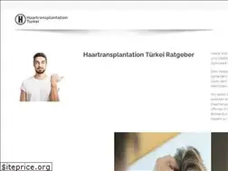 Sites similar to haartransplantation-tuerkei.net