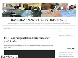 Sites similar to haartransplantation-tv-reportage.at