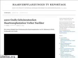 Sites similar to haartransplantation-tv-reportage.com