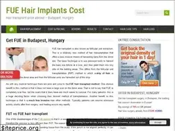 Sites similar to hair-implants.net