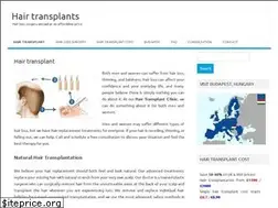 Sites similar to hair-transplants.net