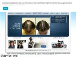 Sites similar to hairgrowthcenters.com