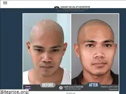 Sites similar to hairscalpcenter.com