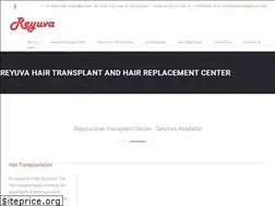 Sites similar to hairstransplant.com
