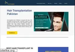 Sites similar to hairtransplantationpakistan.com