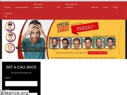 Sites similar to hairtransplantcenterindia.com
