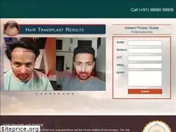 Sites similar to hairtransplantcost.co
