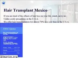 Sites similar to hairtransplantmexicos.com