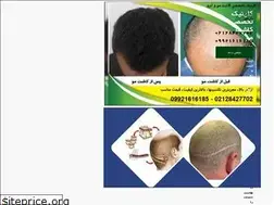Sites similar to hairtransplants.ir