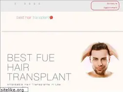 Sites similar to hairtransplantslosangeles.com