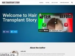 Sites similar to hairtransplantstory.co.uk