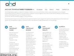 Sites similar to hakandoganayfue.com