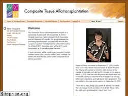 Sites similar to handtransplant.com